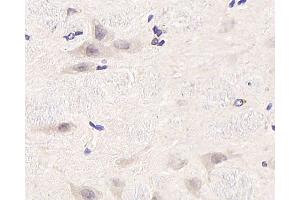Immunohistochemistry analysis of paraffin-embedded rat brain using CDC25A Polyclonal Antibody at dilution of 1:1000. (CDC25A Antikörper)