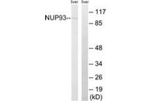 Western blot analysis of extracts from rat liver cells, using NUP93 Antibody. (NUP93 Antikörper  (AA 221-270))