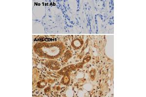 Immunohistochemistry (IHC) image for anti-Cadherin 1, Type 1, E-Cadherin (Epithelial) (CDH1) antibody (ABIN6254215) (E-cadherin Antikörper)