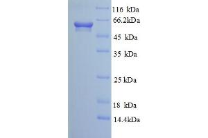 SDS-PAGE (SDS) image for Calcium Activated Nucleotidase 1 (CANT1) (AA 80-397), (partial) protein (GST tag) (ABIN4976339)