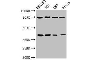 Western Blot Positive WB detected in: HEK293 whole cell lysate, PC-3 whole cell lysate, U87 whole cell lysate, Rat brain tissue All lanes: TRIM54 antibody at 3 μg/mL Secondary Goat polyclonal to rabbit IgG at 1/50000 dilution Predicted band size: 41, 45 kDa Observed band size: 41, 90 kDa (TRIM54 Antikörper  (AA 60-358))
