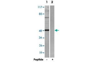 Western blot analysis of extracts from HepG2 cells, using ADRB2 polyclonal antibody . (beta 2 Adrenergic Receptor Antikörper)