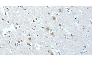 Immunohistochemistry of paraffin-embedded Human brain tissue using ACLY Polyclonal Antibody at dilution 1:40 (ACLY Antikörper)