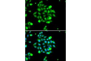 Immunofluorescence analysis of U2OS cells using UBE2G1 antibody (ABIN5974208). (UBE2G1 Antikörper)