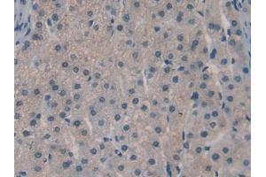 IHC-P analysis of Human Liver Tissue, with DAB staining. (SPRY3 Antikörper  (AA 91-288))