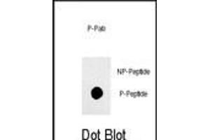 Dot blot analysis of anti-phospho-Sox2-p Phospho-specific Pab (ABIN650873 and ABIN2839817) on nitrocellulose membrane.