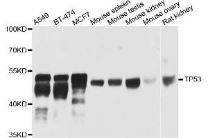 Western blot analysis of extracts of various cells, using TP53 antibody. (p53 Antikörper)