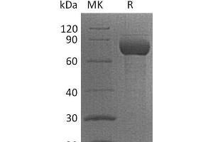 Western Blotting (WB) image for CD38 protein (Fc Tag) (ABIN7320968) (CD38 Protein (Fc Tag))