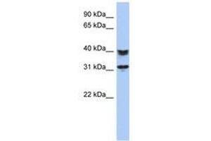Image no. 1 for anti-Chromosome 5 Open Reading Frame 35 (C5orf35) (AA 71-120) antibody (ABIN6741237) (C5orf35 Antikörper  (AA 71-120))