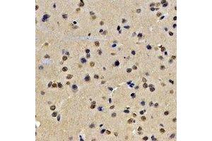 Immunohistochemical analysis of Lamin B2 staining in rat brain formalin fixed paraffin embedded tissue section. (Lamin B2 Antikörper)