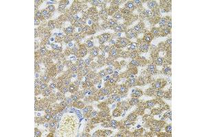 Immunohistochemistry (IHC) image for anti-Centrosomal Protein 164kDa (CEP164) (AA 730-829) antibody (ABIN6138417)