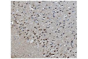 IHC analysis of MAPK1 using anti-MAPK1 antibody (ABIN7600772). (MAPK11 Antikörper  (AA 230-364))