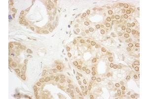Immunohistochemistry (IHC) image for anti-Protein Phosphatase 3, Catalytic Subunit, alpha Isoform (PPP3CA) (C-Term) antibody (ABIN7448738)