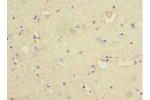 Immunohistochemistry of paraffin-embedded human brain tissue using ABIN7157566 at dilution of 1:100 (KLC1 Antikörper  (AA 274-573))
