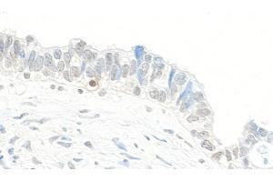 Immunohistochemistry (IHC) image for anti-Topoisomerase (DNA) II beta 180kDa (TOP2B) (AA 1475-1525) antibody (ABIN7453888) (TOP2B Antikörper  (AA 1475-1525))