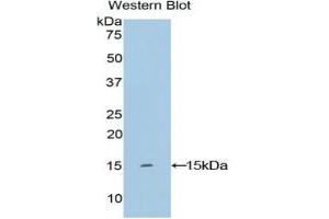 Detection of Recombinant KRT2, Human using Polyclonal Antibody to Keratin 2 (CK2) (Keratin 2 Antikörper  (AA 7-160))