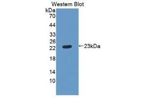 Detection of Recombinant RBP4, Human using Monoclonal Antibody to Retinol Binding Protein 4 (RBP4) (RBP4 Antikörper)