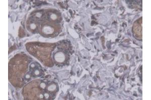 DAB staining on IHC-P; Samples: Rat Skin Tissue (RHAG Antikörper  (AA 251-450))