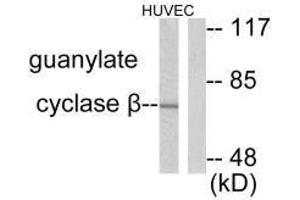 Western blot analysis of extracts from HuvEc cells, using Guanylate Cyclase β antibody. (GUCY1B3 Antikörper)