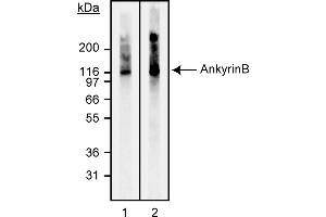 Western Blotting (WB) image for anti-Ankyrin 2, Neuronal (ANK2) antibody (ABIN967633) (ANK2 Antikörper)