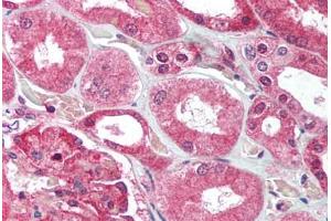 Human Kidney (formalin-fixed, paraffin-embedded) stained with UBE2N antibody ABIN214016 at 2. (UBE2N Antikörper  (C-Term))