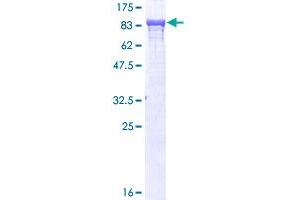 alpha Adducin Protein (AA 1-662) (GST tag)