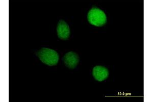 Immunofluorescence of purified MaxPab antibody to TSEN2 on HeLa cell. (TSEN2 Antikörper  (AA 1-465))