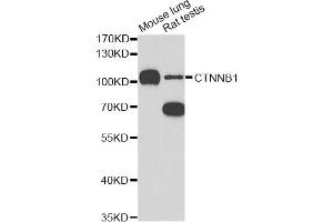 Western blot analysis of extracts of various cell lines, using CTNNB1 antibody (ABIN5997534) at 1/1000 dilution. (CTNNB1 Antikörper)