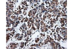 Image no. 4 for anti-Tubulin tyrosine Ligase-Like Family, Member 12 (TTLL12) antibody (ABIN1499035) (TTLL12 Antikörper)