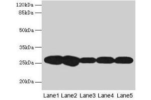 Western blot All lanes: FKBP3 antibody at 4 μg/mL Lane 1: Hela whole cell lysate Lane 2: A431 whole cell lysate Lane 3: PC-3 whole cell lysate Lane 4: Jurkat whole cell lysate Lane 5: 293T whole cell lysate Secondary Goat polyclonal to rabbit IgG at 1/10000 dilution Predicted band size: 26 kDa Observed band size: 26 kDa (FKBP3 Antikörper  (AA 2-224))