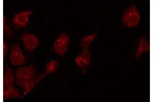 ABIN6275445 staining Hela by IF/ICC. (RAPGEF3 Antikörper  (C-Term))