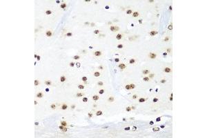 Immunohistochemistry of paraffin-embedded mouse brain using HT antibody  at dilution of 1:100 (40x lens). (HTATSF1 Antikörper  (AA 1-270))