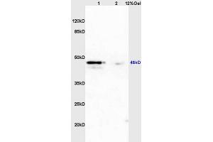 Lane 1: mouse uterus lysates Lane 2: mouse brain lysates probed with Anti PAX2 Polyclonal Antibody, Unconjugated (ABIN738951) at 1:200 in 4 °C. (PAX2A Antikörper)