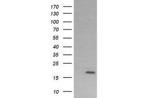 Image no. 2 for anti-Cancer/testis Antigen 1B (CTAG1B) antibody (ABIN1499903) (CTAG1B Antikörper)