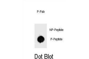 Dot blot analysis of Phospho-BAD-S34 Antibody Phospho-specific Pab m on nitrocellulose membrane. (BAD Antikörper  (pSer34))