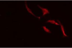 ABIN6275484 staining HeLa cells by IF/ICC.