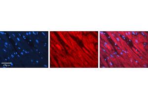 Rabbit Anti-AKT2 Antibody  AV Formalin Fixed Paraffin Embedded Tissue: Human heart Tissue Observed Staining: Cytoplasmic Primary Antibody Concentration: 1:100 Other Working Concentrations: N/A Secondary Antibody: Donkey anti-Rabbit-Cy3 Secondary Antibody Concentration: 1:200 Magnification: 20X Exposure Time: 0. (AKT2 Antikörper  (N-Term))