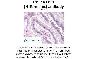 Image no. 1 for anti-Regulator of Telomere Elongation Helicase 1 (RTEL1) antibody (ABIN1738970) (RTEL1 Antikörper)