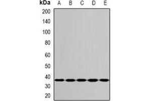 Western blot analysis of RPS3A expression in MCF7 (A), A549 (B), mouse liver (C), mouse lung (D), rat ovary (E) whole cell lysates.