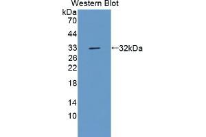 Detection of Recombinant AGC, Cattle using Polyclonal Antibody to Aggrecan (AGC) (Aggrecan Antikörper  (AA 2066-2316))