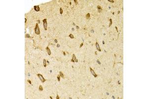 Immunohistochemistry of paraffin-embedded rat brain using APLP1 antibody at dilution of 1:200 (400x lens). (APLP1 Antikörper)