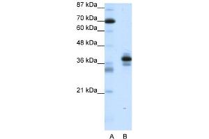 WB Suggested Anti-PITX1 Antibody Titration:  1.