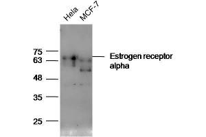 Lane 1: HeLa lysates Lane 2: MCF7 lysates probed with Anti-Estrogen receptor alpha Polyclonal Antibody, Unconjugated  at 1:5000 for 90 min at 37˚C. (Estrogen Receptor alpha Antikörper  (AA 241-300))
