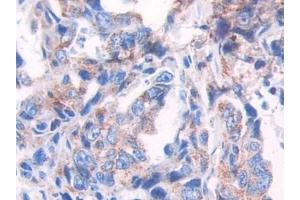 Immunohistochemistry (IHC) image for anti-Heat Shock 60kDa Protein 1 (Chaperonin) (HSPD1) (AA 172-343) antibody (ABIN7438895)