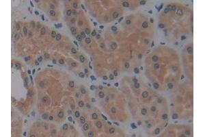 DAB staining on IHC-P; Samples: Human Kidney Tissue (MMP14 Antikörper  (AA 112-321))