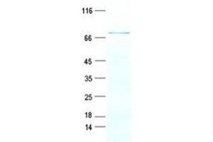 Validation with Western Blot (Kyphoscoliosis Peptidase Protein (KY) (His tag))