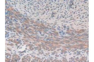 IHC-P analysis of Mouse Uterus Tissue, with DAB staining. (Gelsolin Antikörper  (AA 432-625))