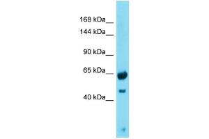 Western Blotting (WB) image for anti-Growth Regulation By Estrogen in Breast Cancer 1 (GREB1) (N-Term) antibody (ABIN2774550) (GREB1 Antikörper  (N-Term))