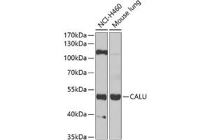 Western blot analysis of extracts of various cell lines, using CALU antibody (ABIN6129533, ABIN6137878, ABIN6137880 and ABIN6222201) at 1:1000 dilution. (CALU Antikörper  (AA 20-315))