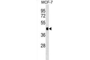 Western Blotting (WB) image for anti-Immediate Early Response 5 (IER5) antibody (ABIN2999398) (IER5 Antikörper)